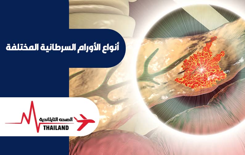 علاج السرطان والاورام السرطانية في تايلاند