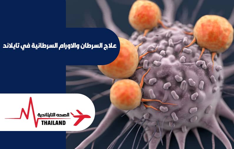علاج السرطان والاورام السرطانية في تايلاند