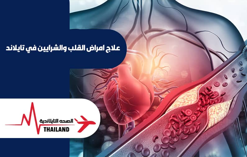 علاج امراض القلب والشرايين في تايلاند